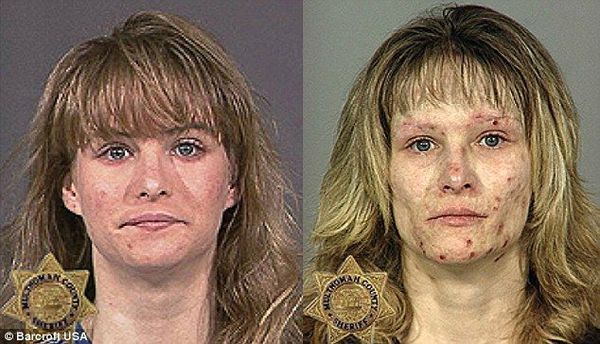 Before after Meth photo...