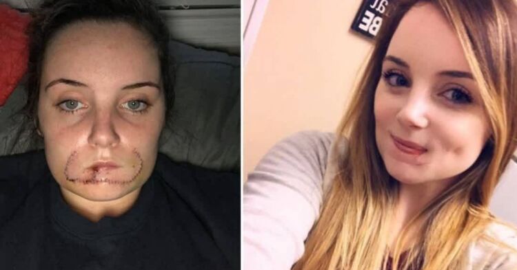 Her Ex Bit Her Entire Lip Off, His Reason Is Absolutely Horrifying: Her ...